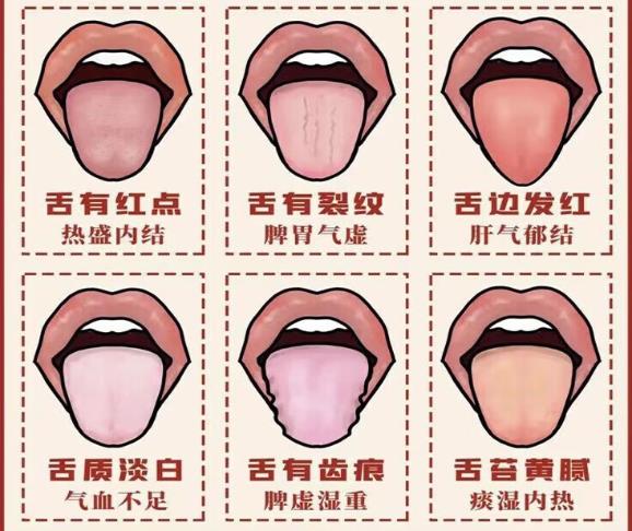 新AI算法“望舌診病”成功率達(dá)98%，或?qū)⒏镄轮嗅t(yī)診斷